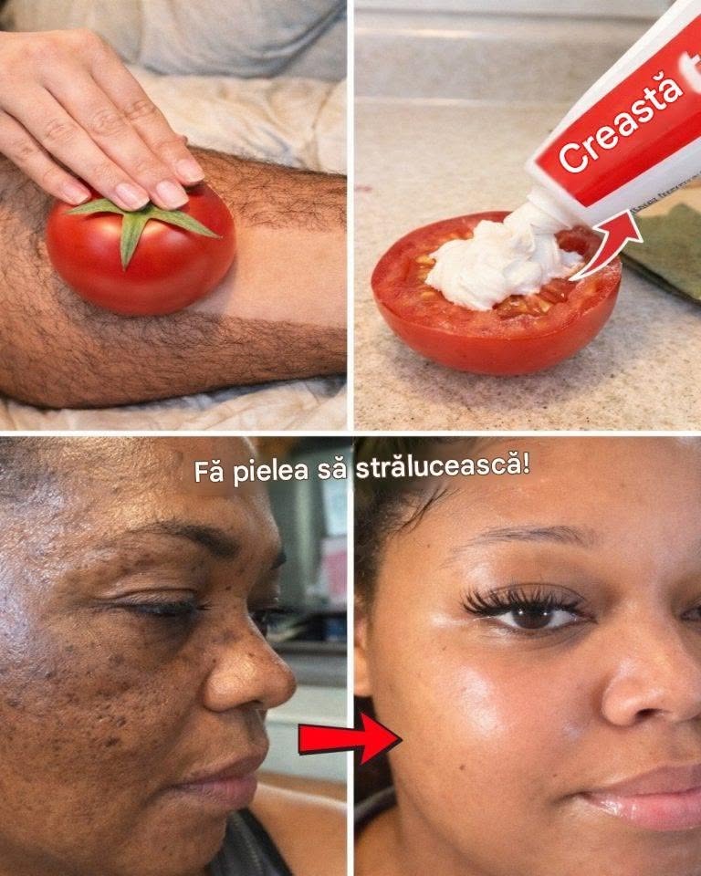 Descoperă masca virală de pastă de dinți și roșii pe care mulți o încearcă pentru a obține un aspect mai mic, pete întunecate estompate, piele mai luminoasă și o reducere mai blândă a părului facial