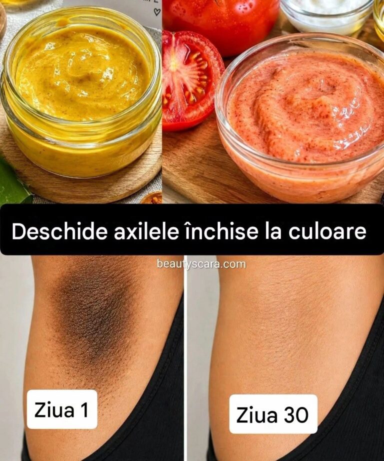 Deschideți axilele întunecate. Comentați „Lught” pentru rețetă