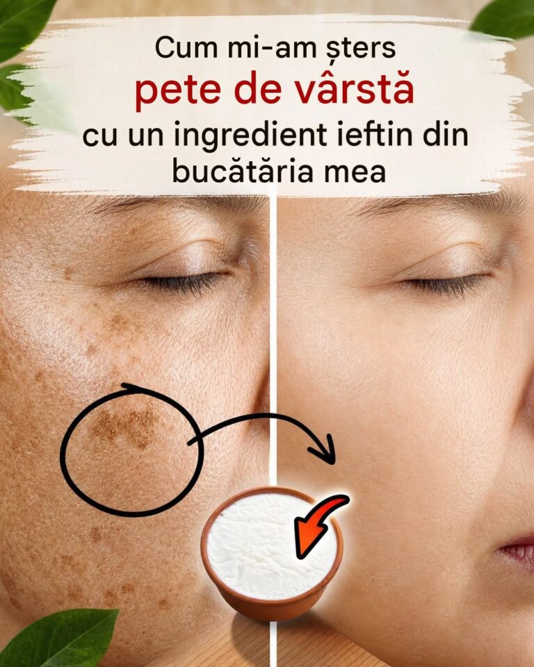 Cum am scăpat de petele de bătrânețe cu un ingredient ieftin din bucătărie